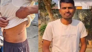 Loan of Rs 1 lakh became Rs 50 lakh, land, jewelery sold and kidney also had to be sold.